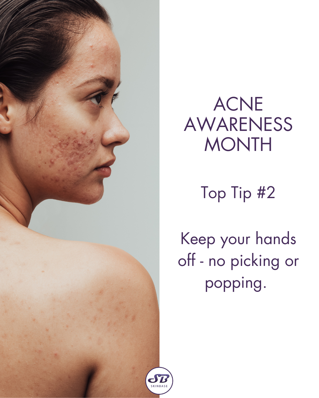 Acne Awareness Month Microdermabrasion Grid Post Series