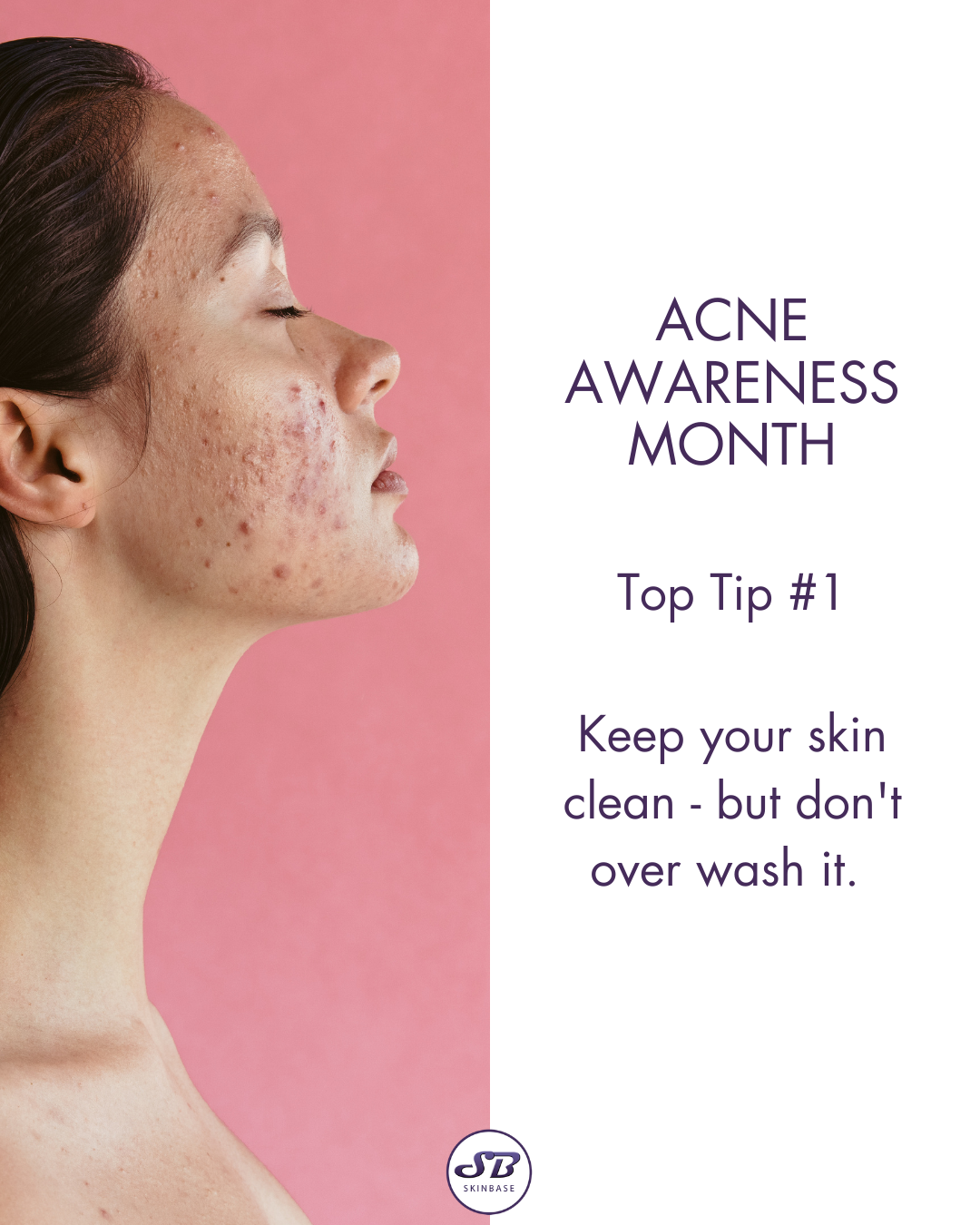 Acne Awareness Month Microdermabrasion Grid Post Series